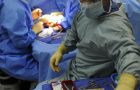 Vetenskapen bakom transplantationer